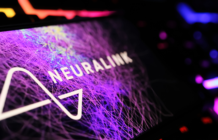 Neuralink, Synchron, Precision – rewolucja czy bańka za 400 mld USD?